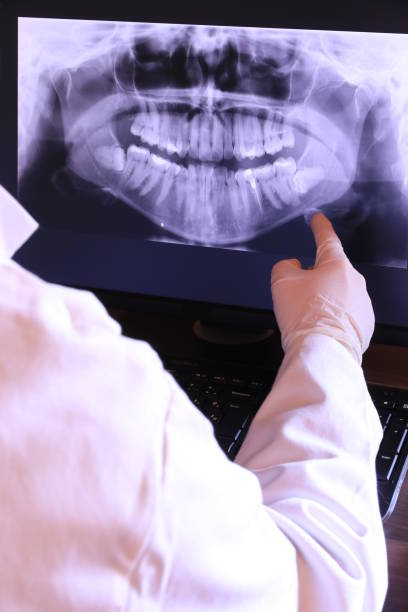 Best Knocked-Out Tooth Emergency  in Deschutes River Woods, OR